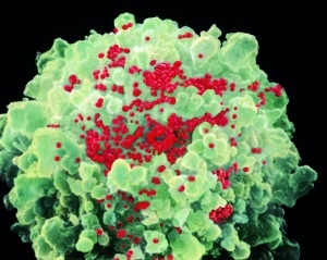 Hires_reduced_m0500418-hiv_viruses_red_-spl